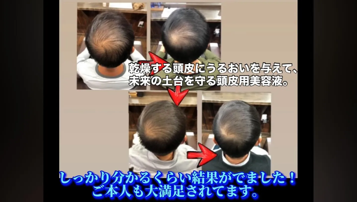 乾燥する頭皮にうるおいを与えて、未来の土台を守る頭皮用美容液...